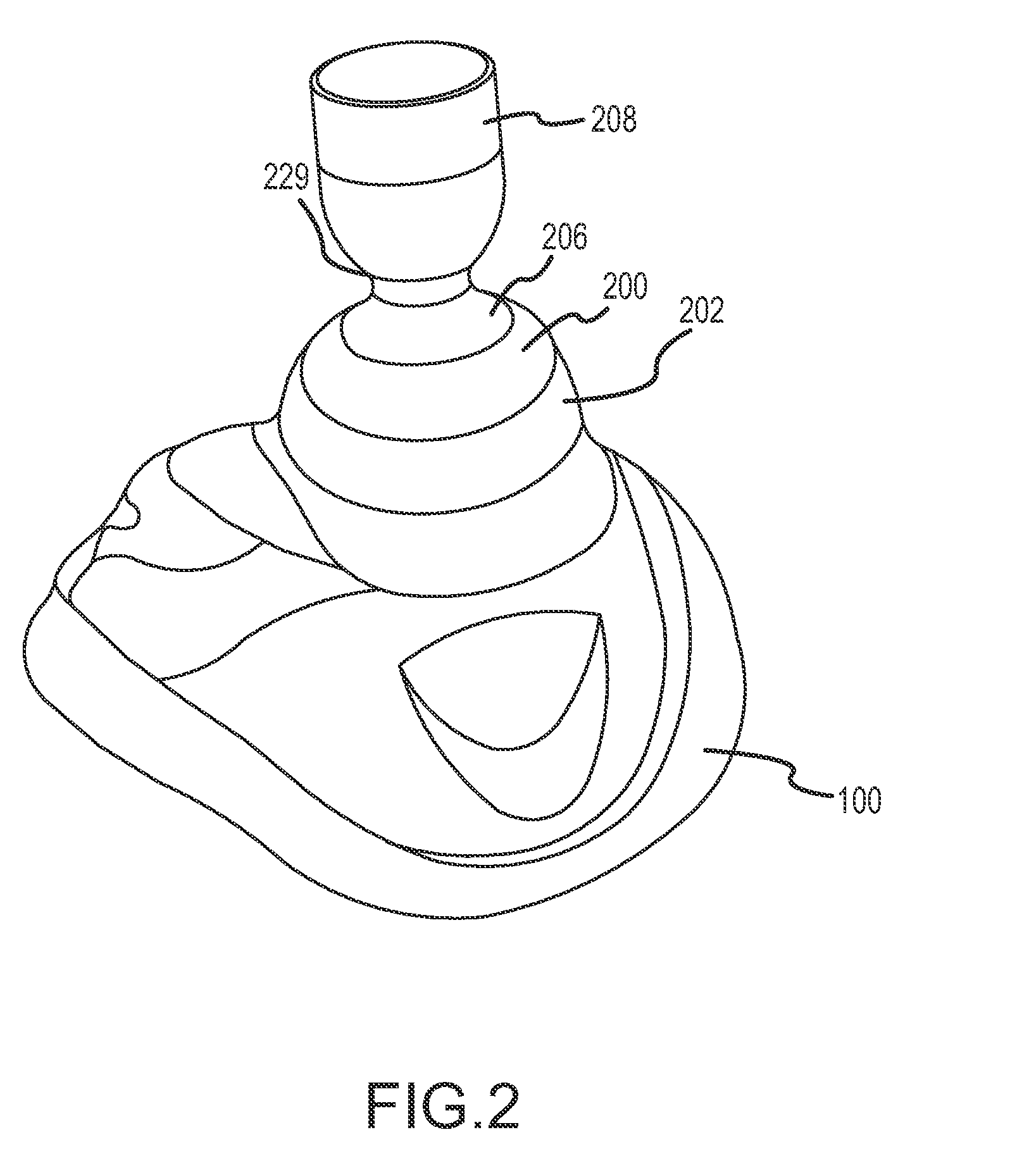 Vacuum and positive pressure ventilation systems and methods for intrathoracic pressure regulation