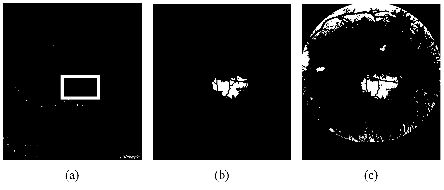 Fluorescence angiography fundus image extraction method based on NGC-ACM