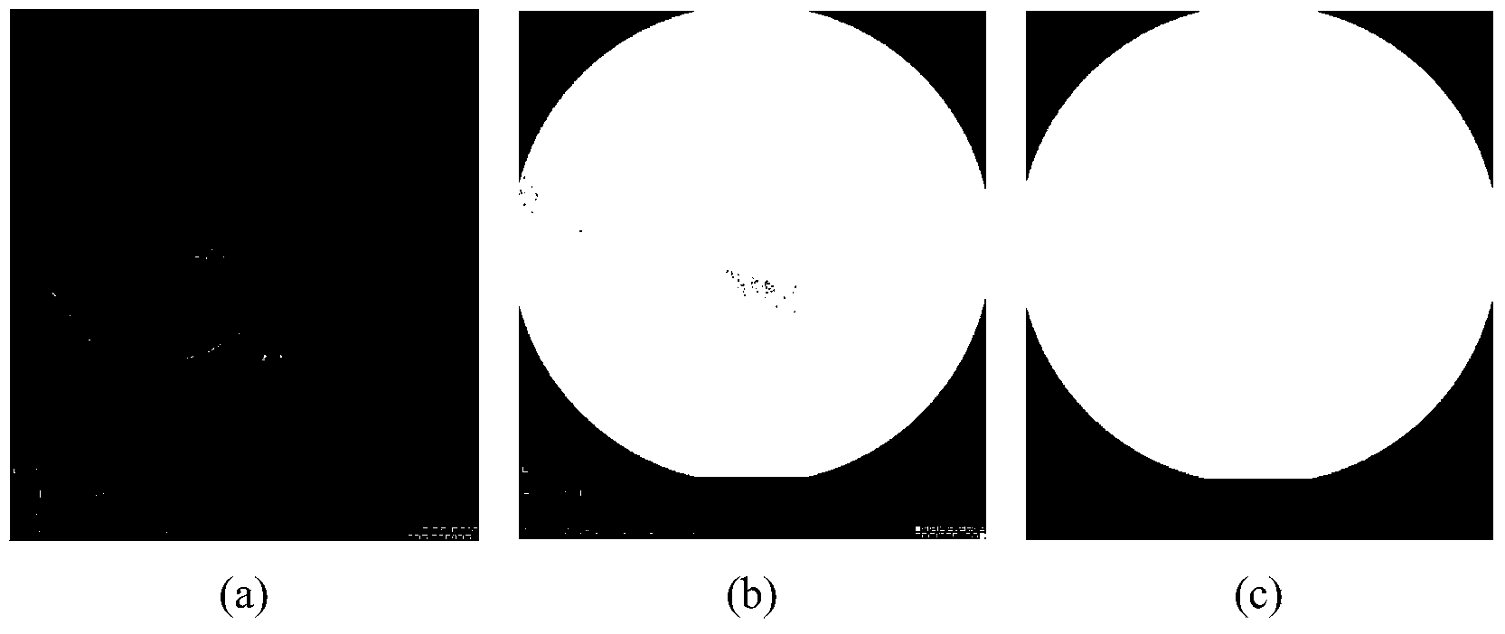 Fluorescence angiography fundus image extraction method based on NGC-ACM