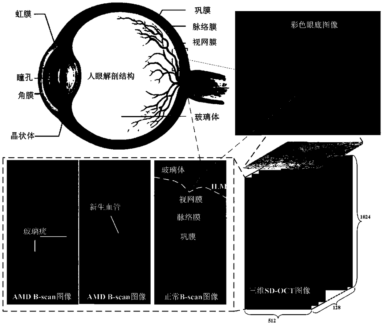 GA lesion segmentation method based on depth-concatenated model for SD-OCT images