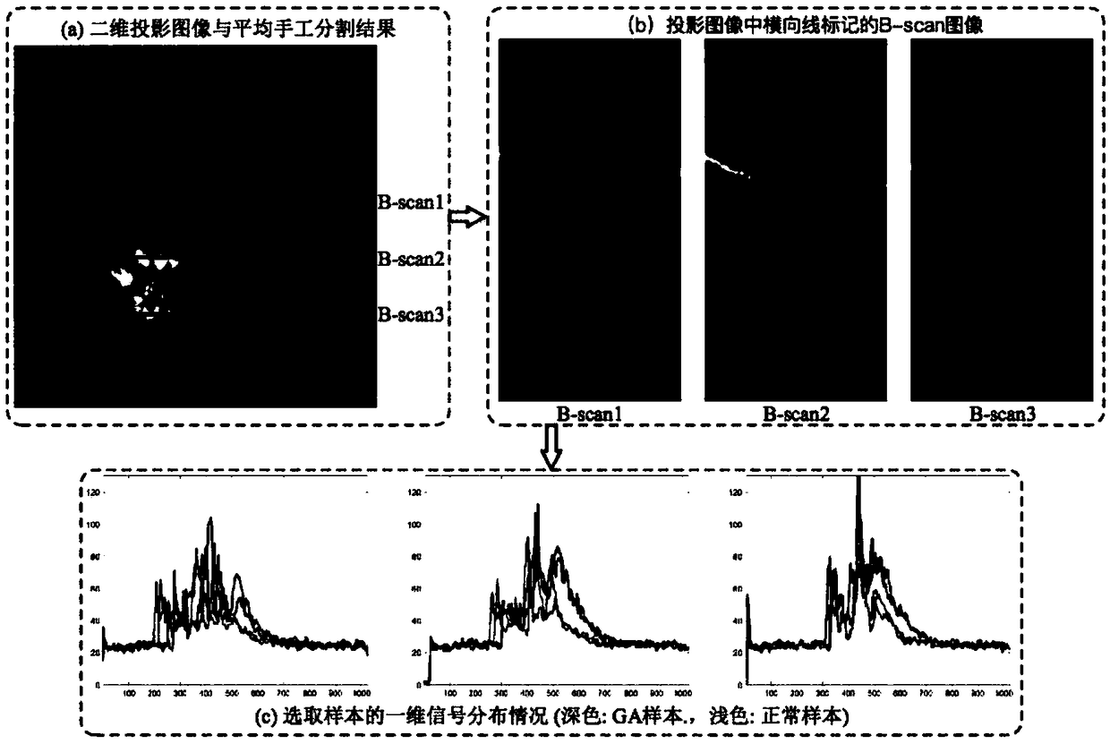 GA lesion segmentation method based on depth-concatenated model for SD-OCT images