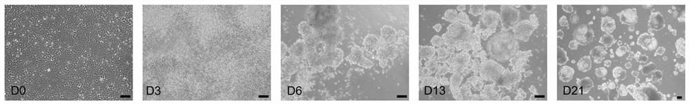 Method for differentiating and inducing stem cells into hepatocytes