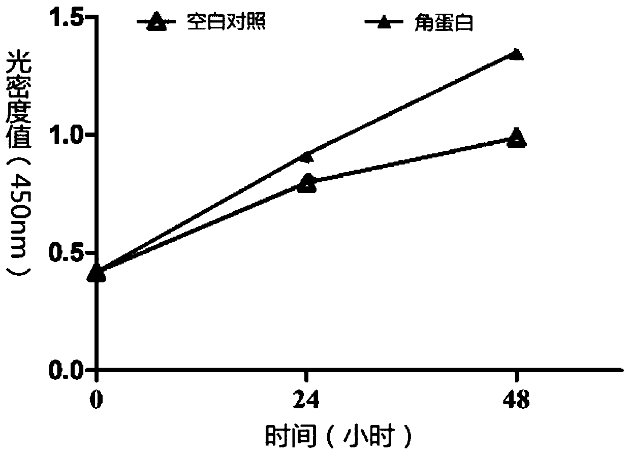 Composition for preparing keratin gel dressings as well as preparation method and application thereof