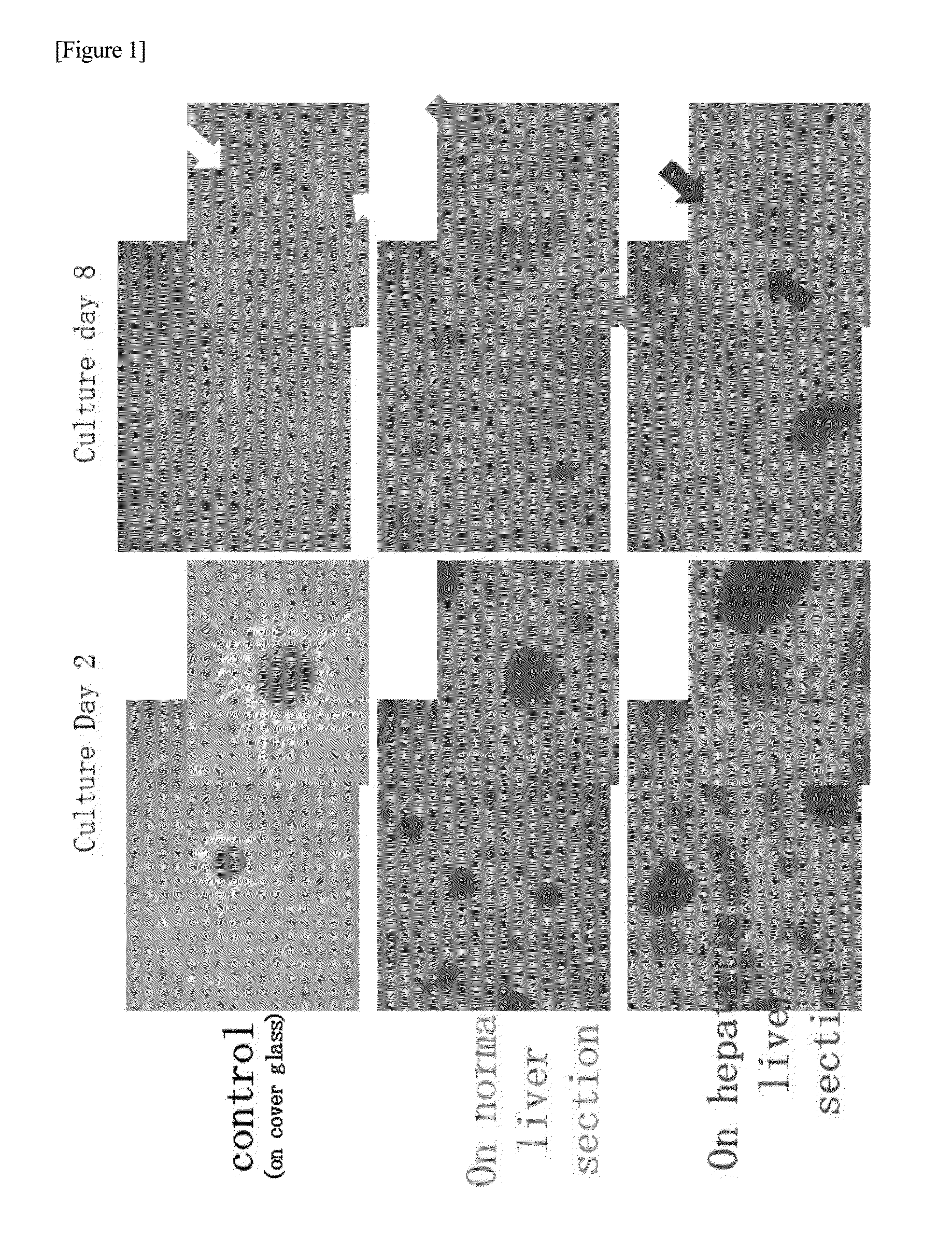 Method for inducing differentiation of induced pluripotent stem cells and method for selecting the same