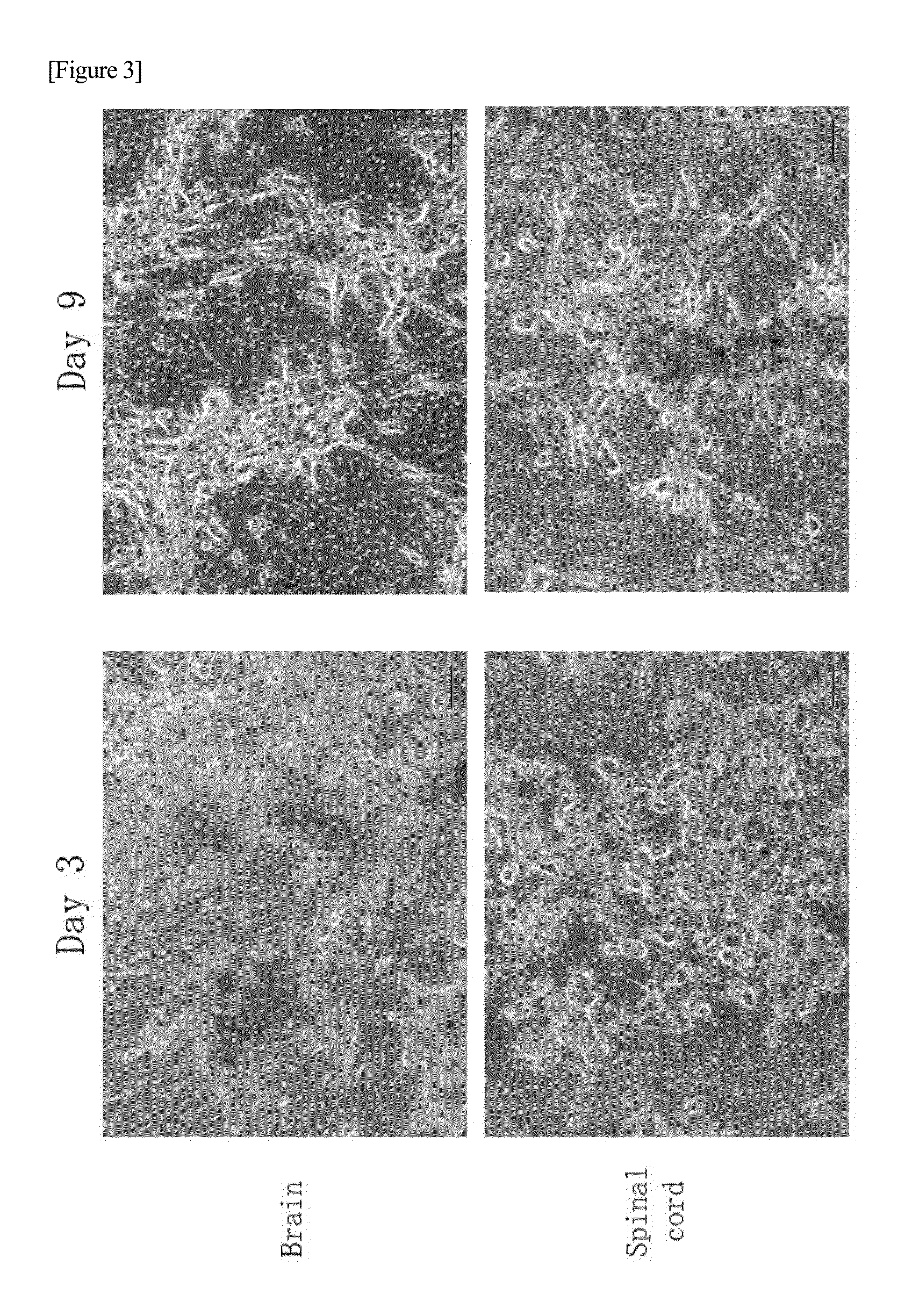 Method for inducing differentiation of induced pluripotent stem cells and method for selecting the same