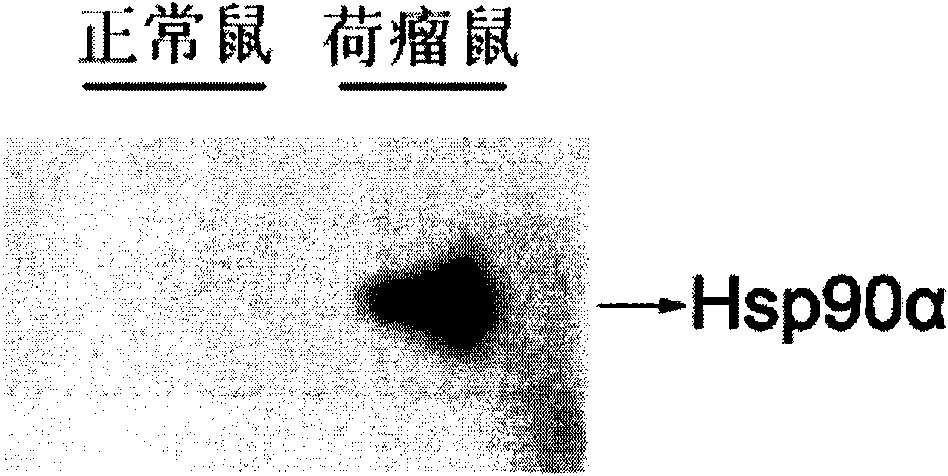 Novel tumor marker