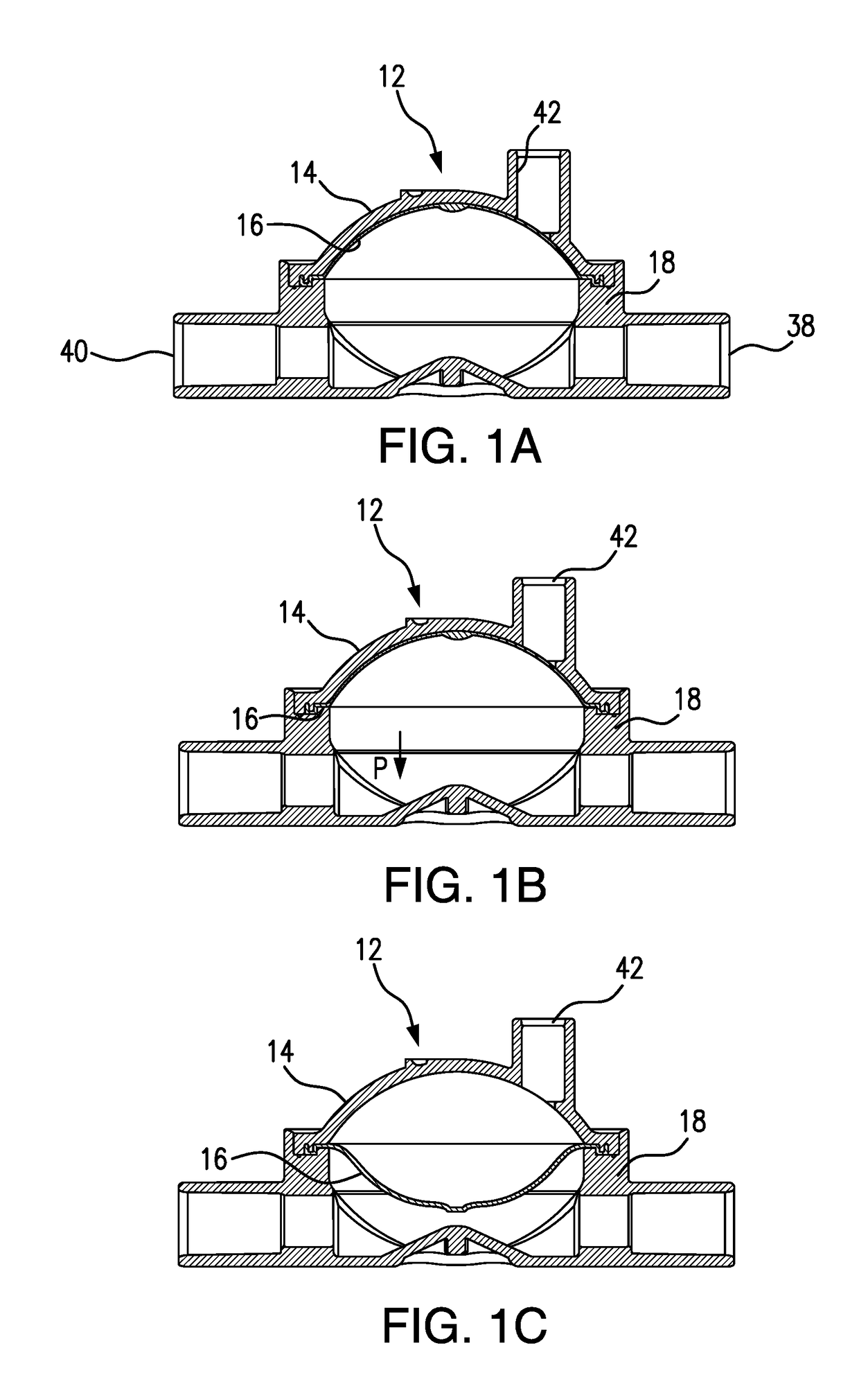 Pressure Output Device For Extracorporeal Hemodialysis Machine