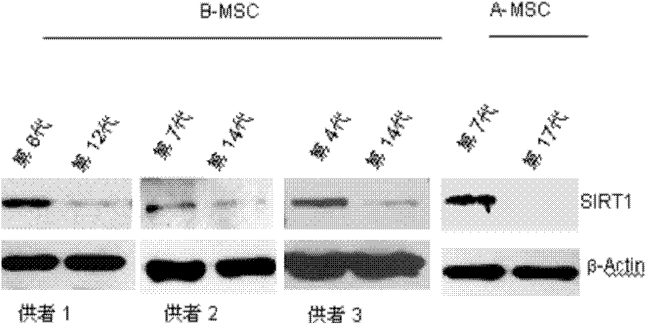 Application of protein acetylation enzyme SIRT1 (Silent Mating type Information Regulation 2Homolog1) in promoting proliferation and delaying senility of mesenchymal stem cells