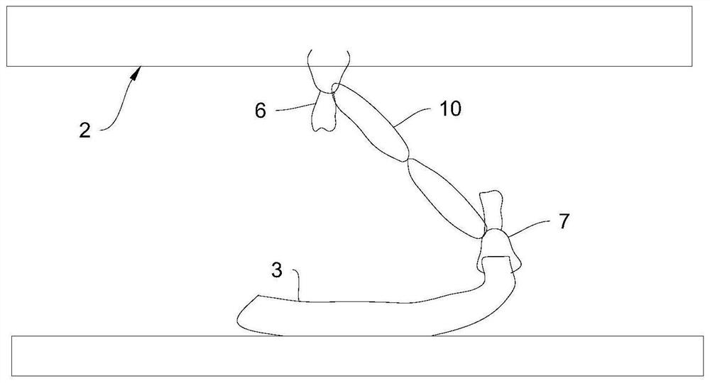 Mucous membrane traction device and endoscopic system