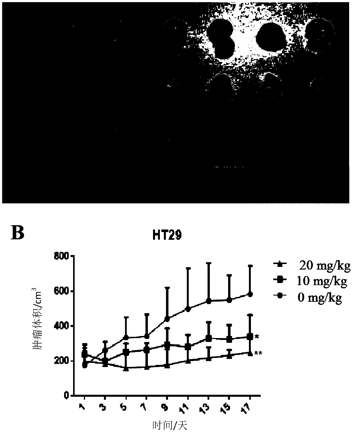 Application of aripiprazole in preparation of antineoplastic drug