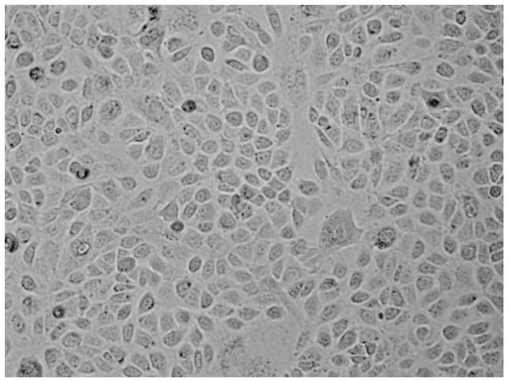 Mouse esophageal squamous carcinoma cell line as well as establishment method and application thereof