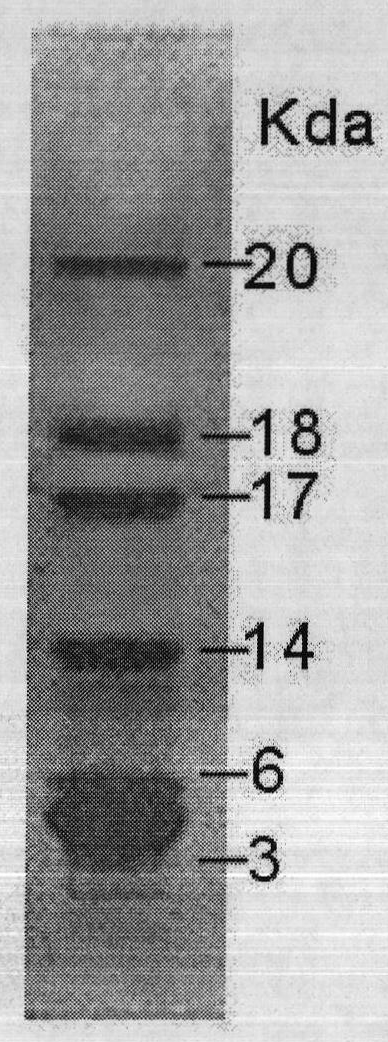 Spleen immune factor and its preparation method