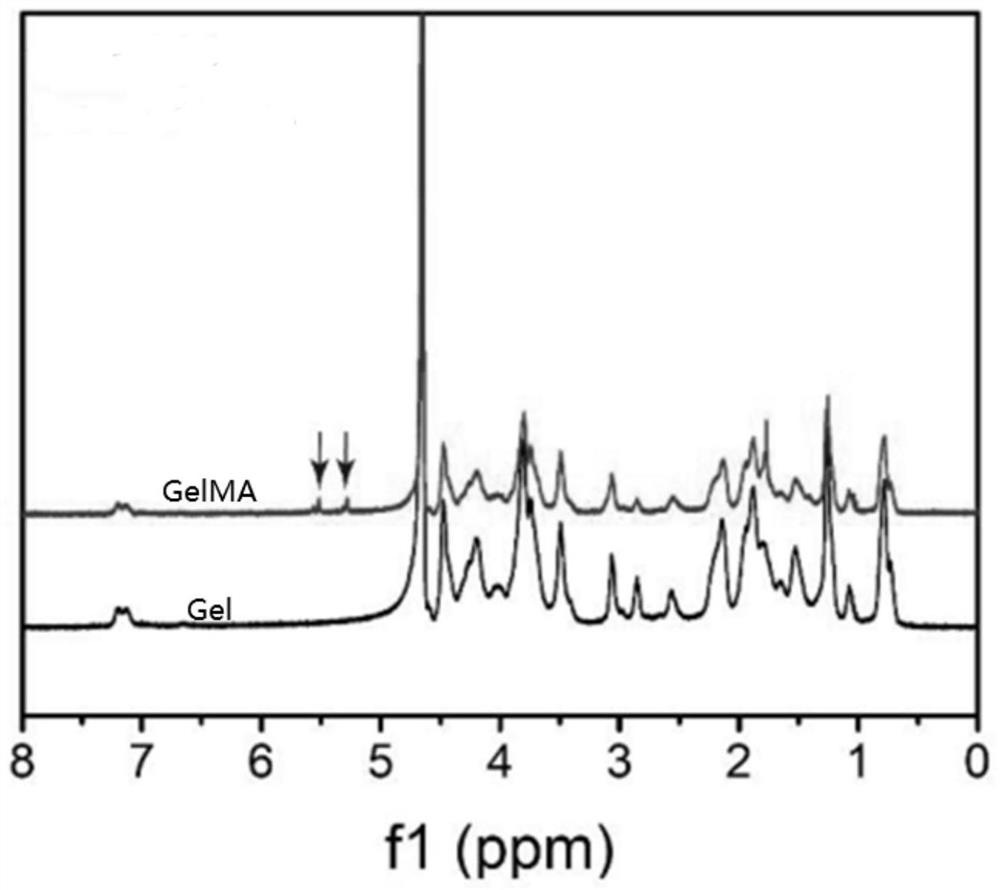 3D printing hydrogel for treating or preventing intrauterine adhesion and preparation method of hydrogel