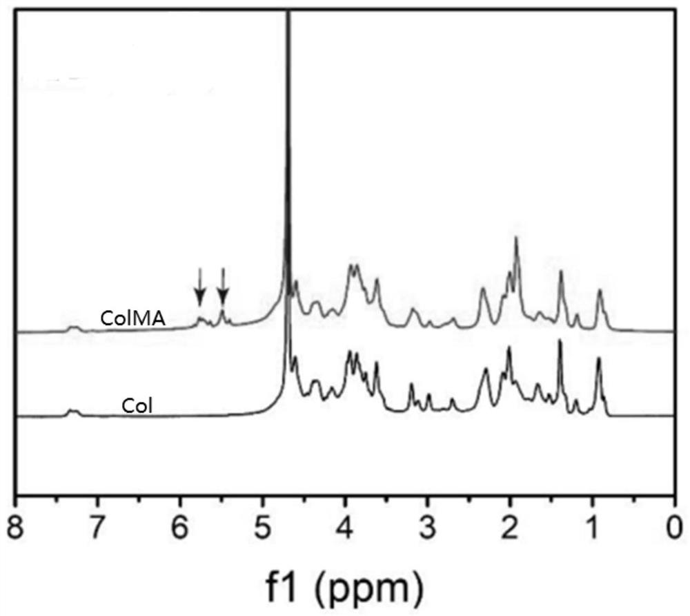 3D printing hydrogel for treating or preventing intrauterine adhesion and preparation method of hydrogel