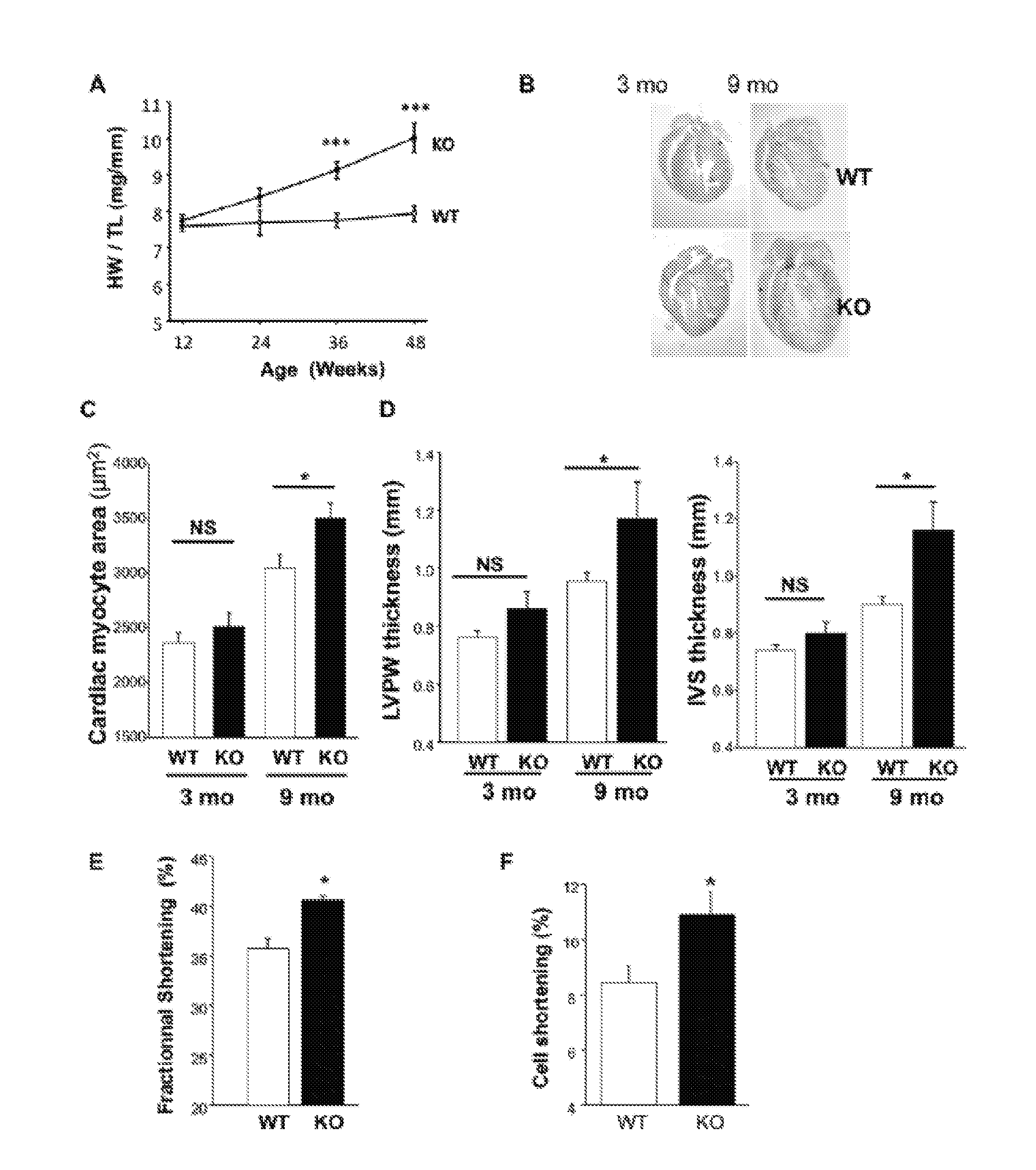 Inhibitors of MRP4 and agents stimulating MRP4 activity for the treatment of cardiac disorders