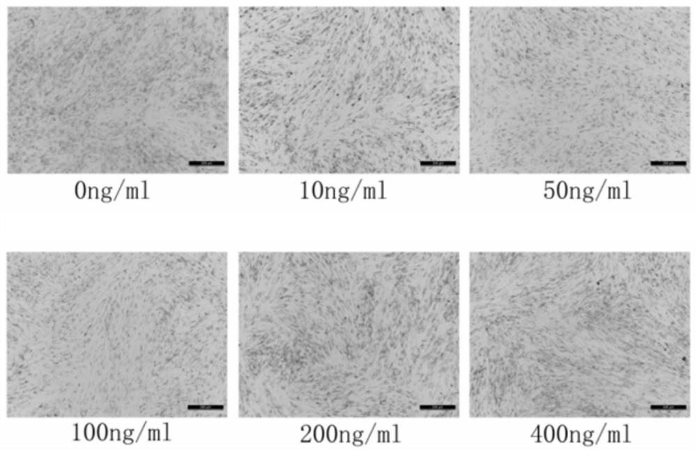 Application of chicken CTGF gene in inhibition of chicken preadipocyte differentiation