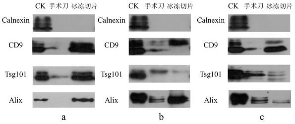 Method for increasing tissue exosome yield by using freezing microtome