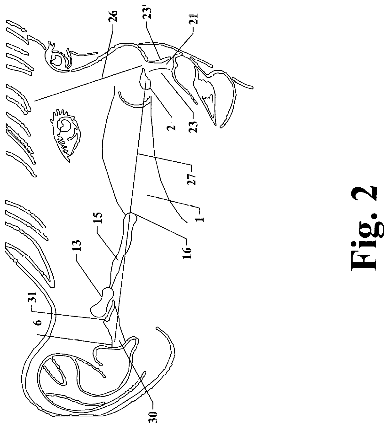 Method for enhancing eustachian tube patency and treatment of otitis media