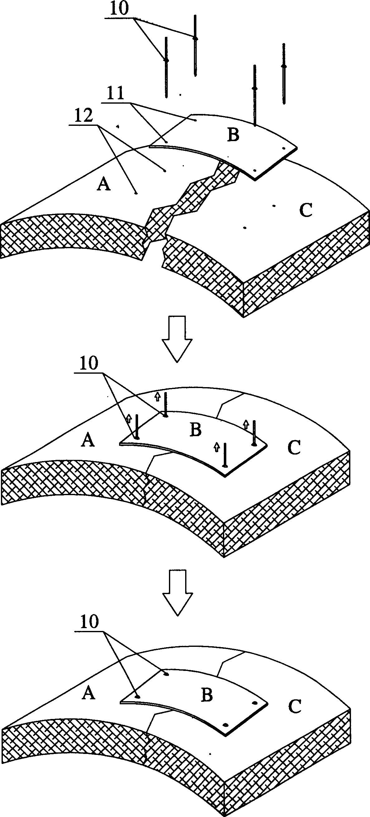 Skeleton fixation method for medical use, and its fixation nails