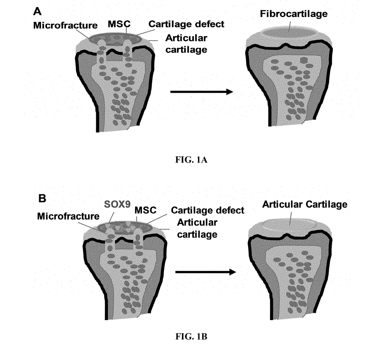 Methods for repairing cartilage damage