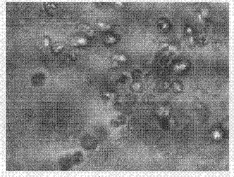 Cell line for lowly-metastatic clear cell carcinoma of kidney of Han Chinese