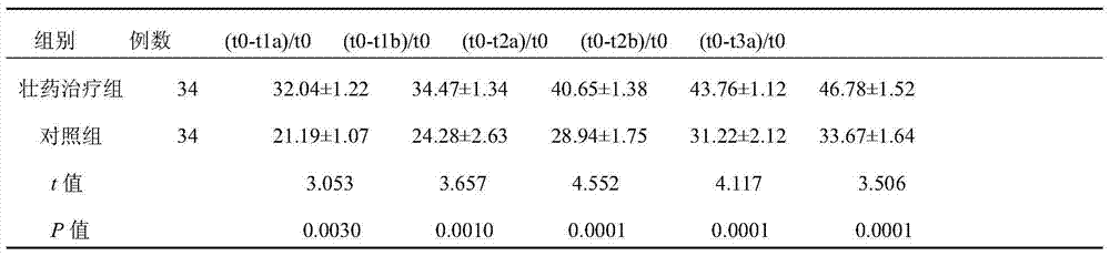 Formula of Zhuang medicine for removing miasma and resisting influenza