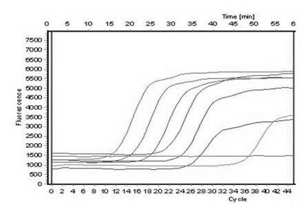 SYBR GreenI real-time quantitative polymerase chain reaction (PCR) detection method for S gene of transmissible gastroenteritis virus of swine