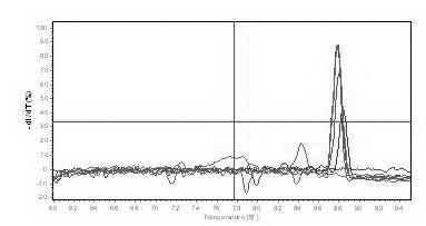 SYBR GreenI real-time quantitative polymerase chain reaction (PCR) detection method for S gene of transmissible gastroenteritis virus of swine