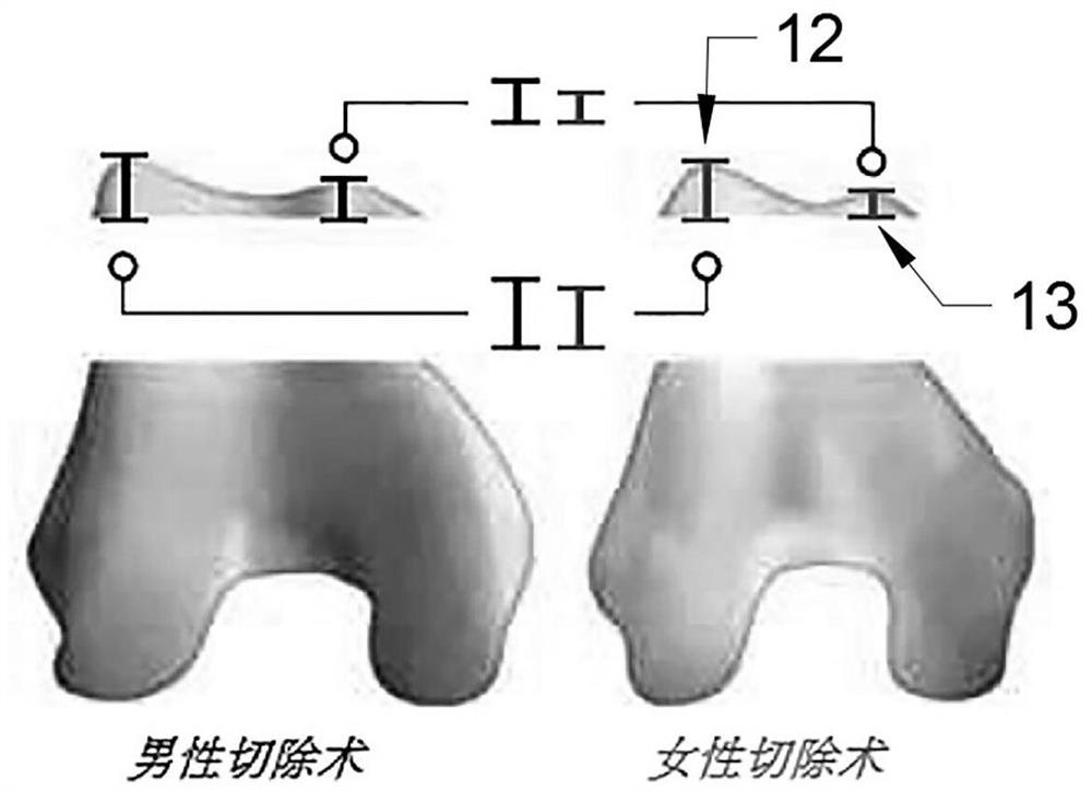 Female knee joint prosthesis and design method thereof