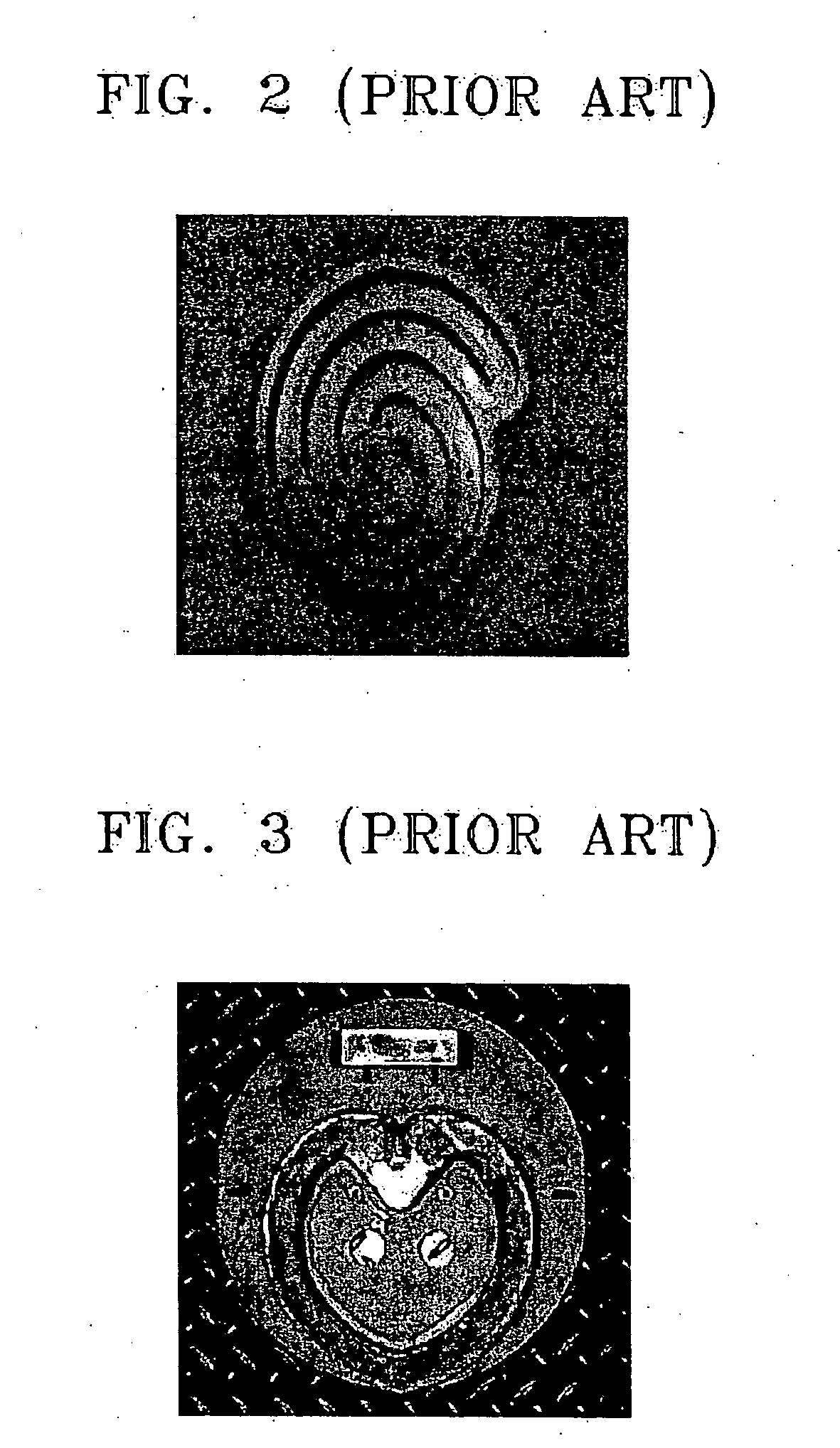 Method of manufacturing a rotation-magnetron-in-magnetron (RMIM) electrode