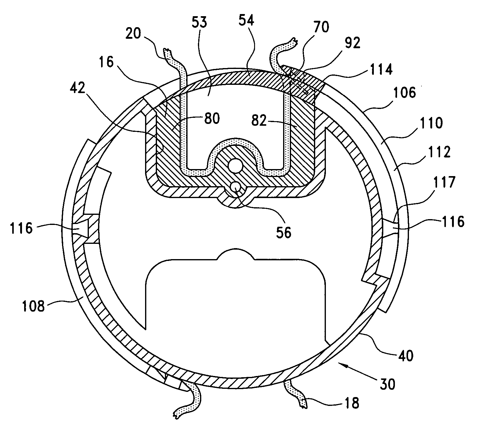 Method and apparatus for endoscopically performing gastric reduction surgery in a single step