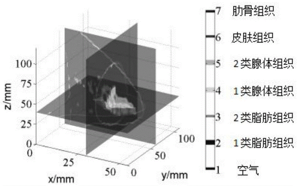 Ultra-wideband breast tumor imaging method based on magnetic resonance image compensation