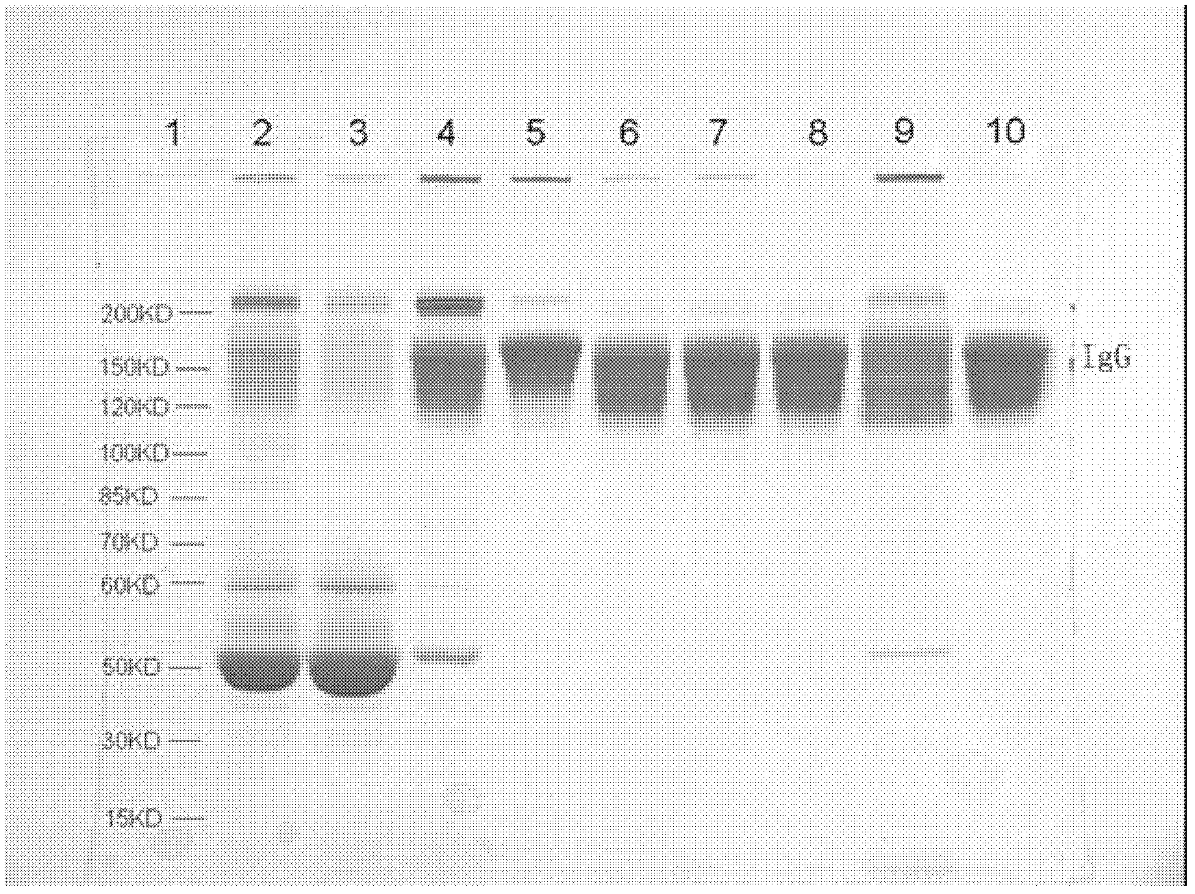 Human cytomegalovirus immunoglobulin for intravenous injection and preparation method thereof