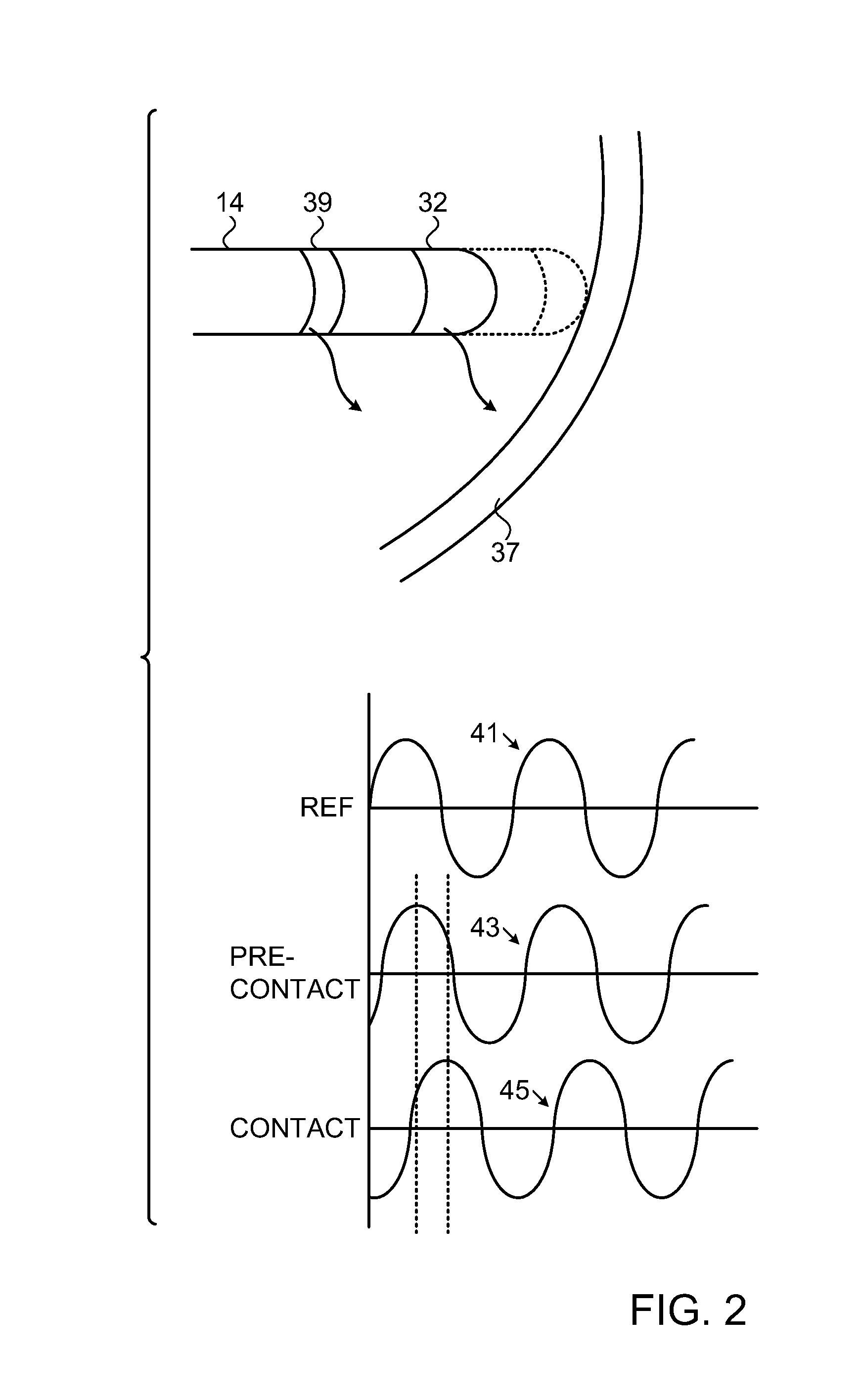 Machine learning in determining catheter electrode contact