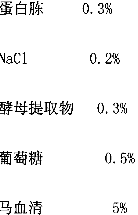 Strangles streptococcus strain XZ1 and application of strangles streptococcus strain XZ1 in strangles vaccine