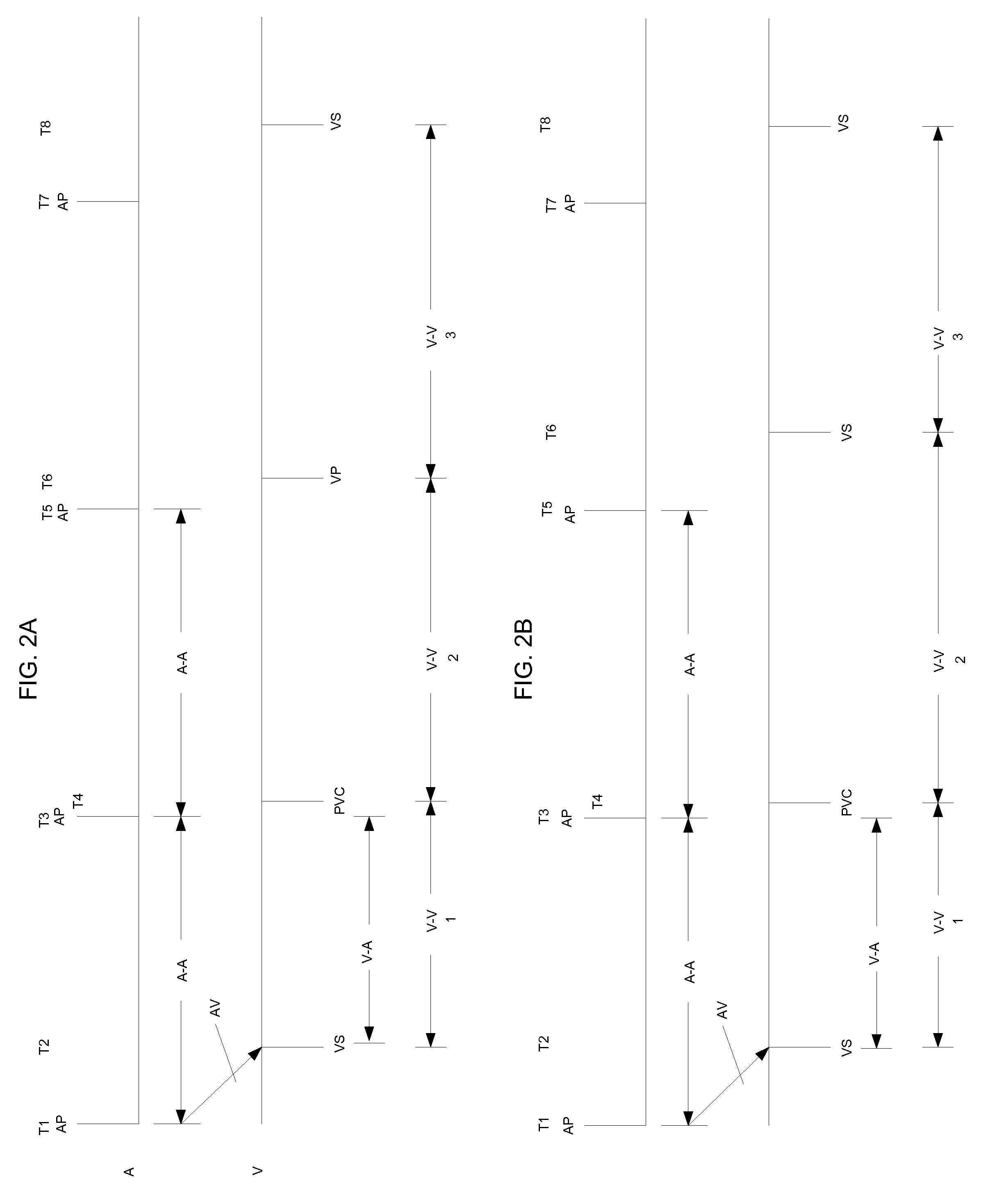 System and method for promoting intrinsic conduction through atrial timing