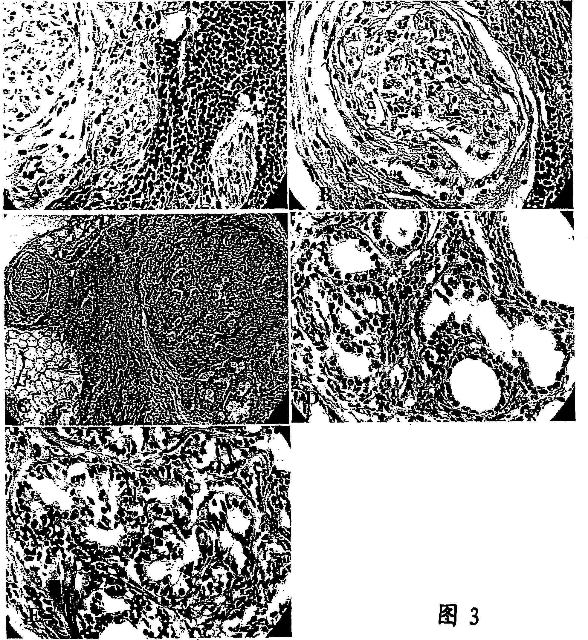 Human pancreatic epithelial progenitor cells and methods of isolation and use thereof