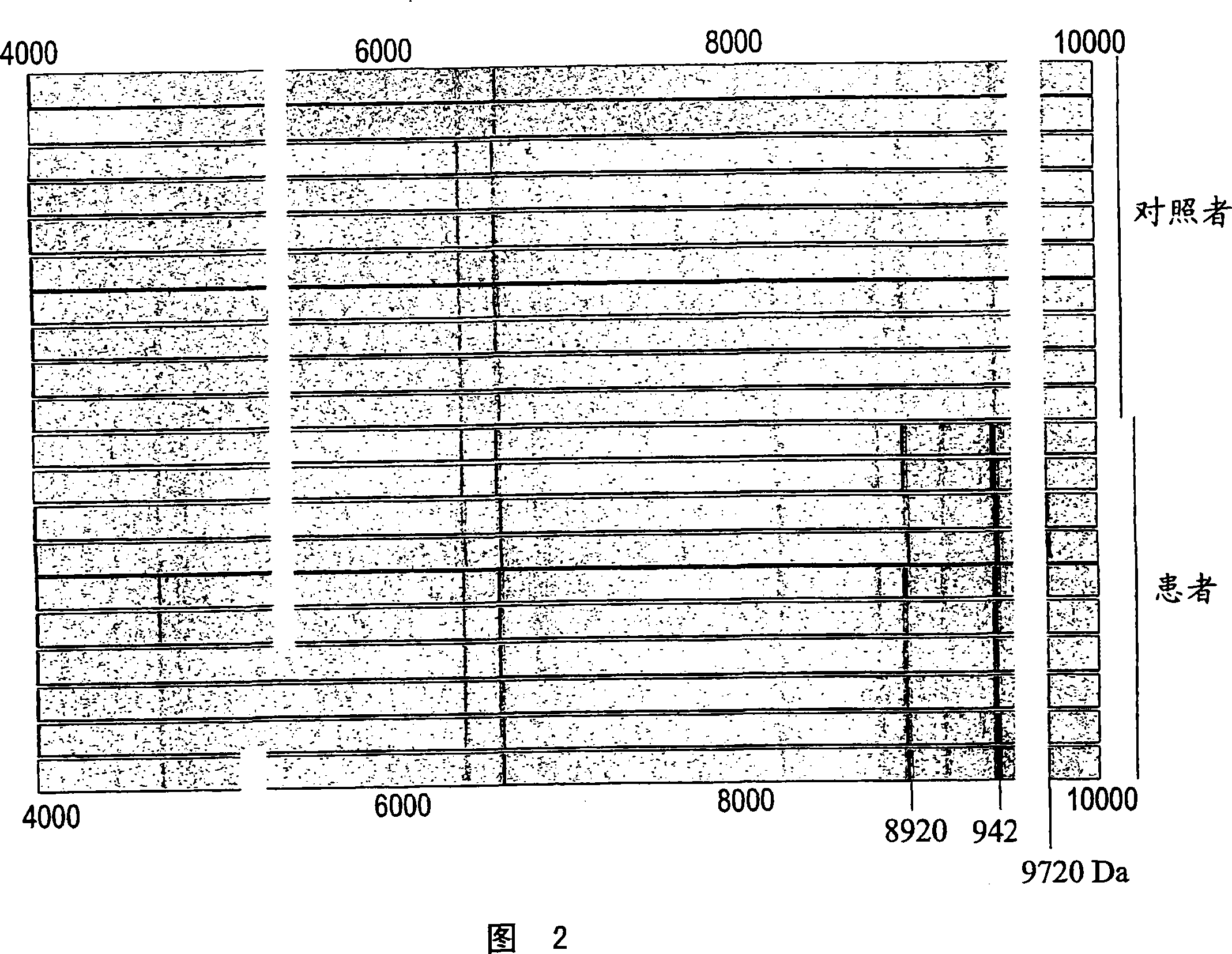 A method and a kit for diagnosing type 2 diabetes, metabolic syndrome, sub clinical atherosclerosis, myocardial infarct, stroke or clinical manifestations of diabetes.