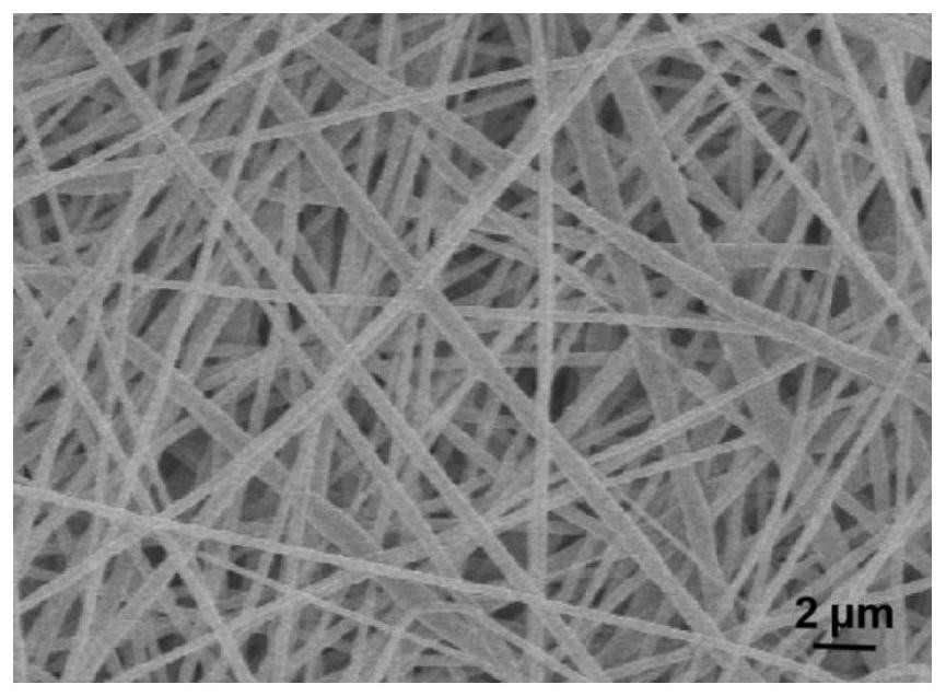 A kind of artificial periosteum loaded with deferoxamine and its preparation method