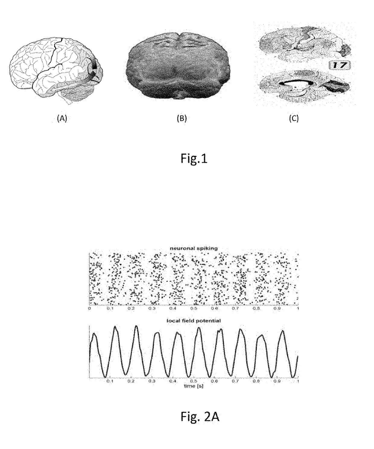 Using Helmholtz Minimum Free Energy Slopes to Define Glial Cells that Diagnose Brain Disorder