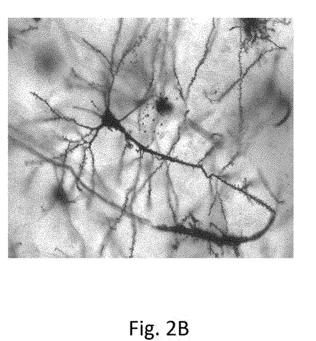 Using Helmholtz Minimum Free Energy Slopes to Define Glial Cells that Diagnose Brain Disorder