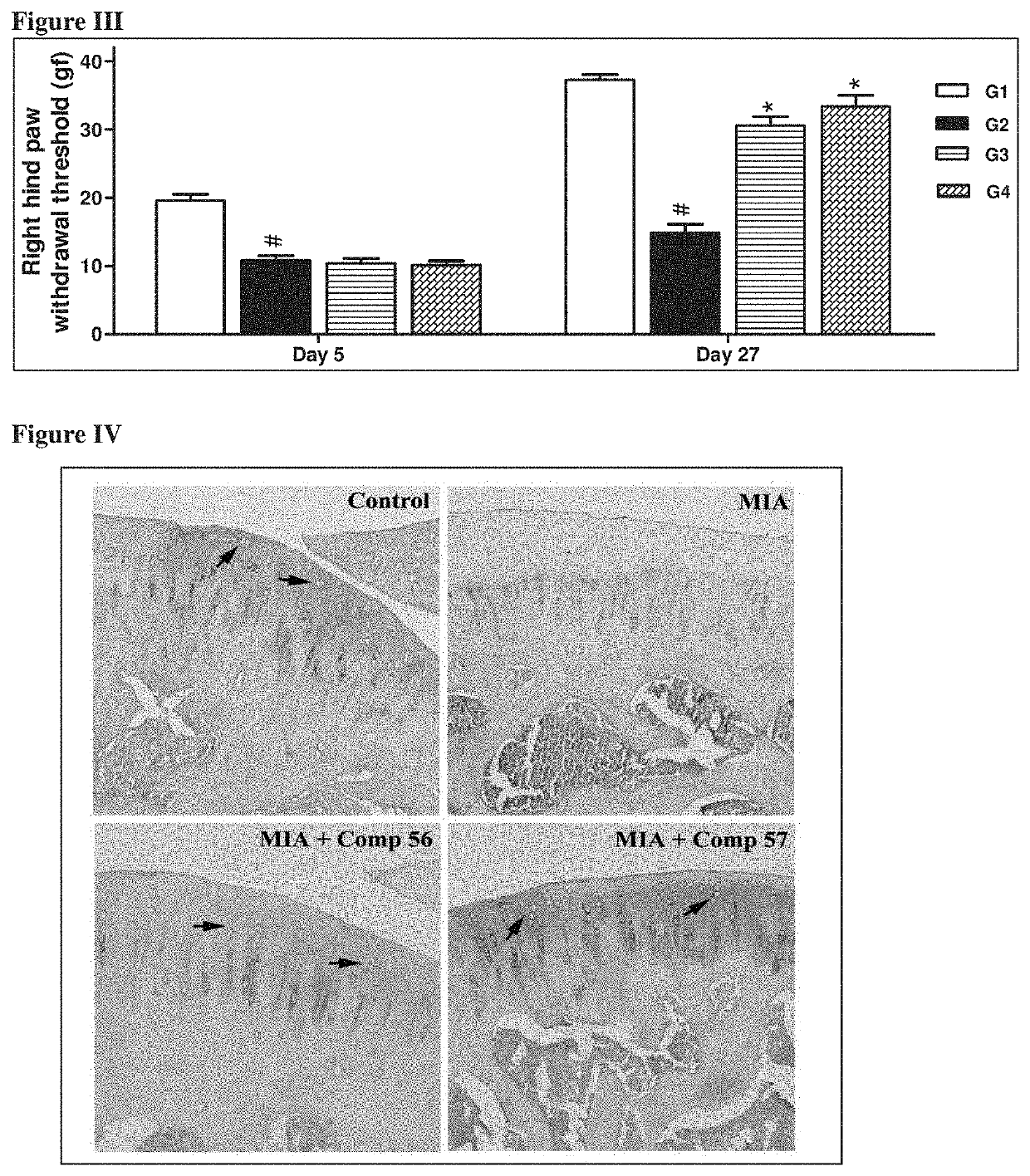 Synergistic herbal compositions for prevention, treatment or control of pain and/or cartilage regeneration