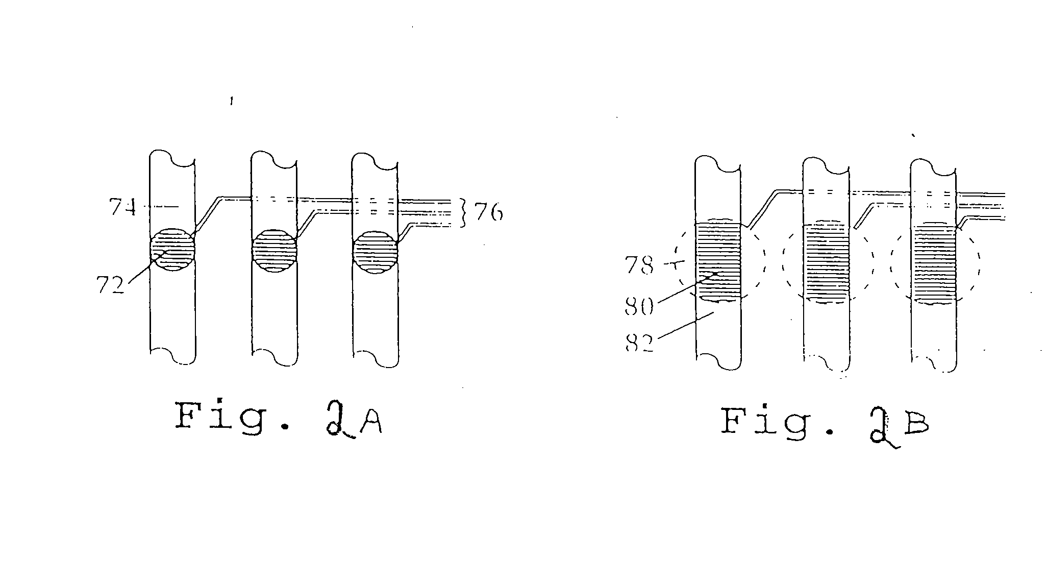 Microfabricated Cell Sorter