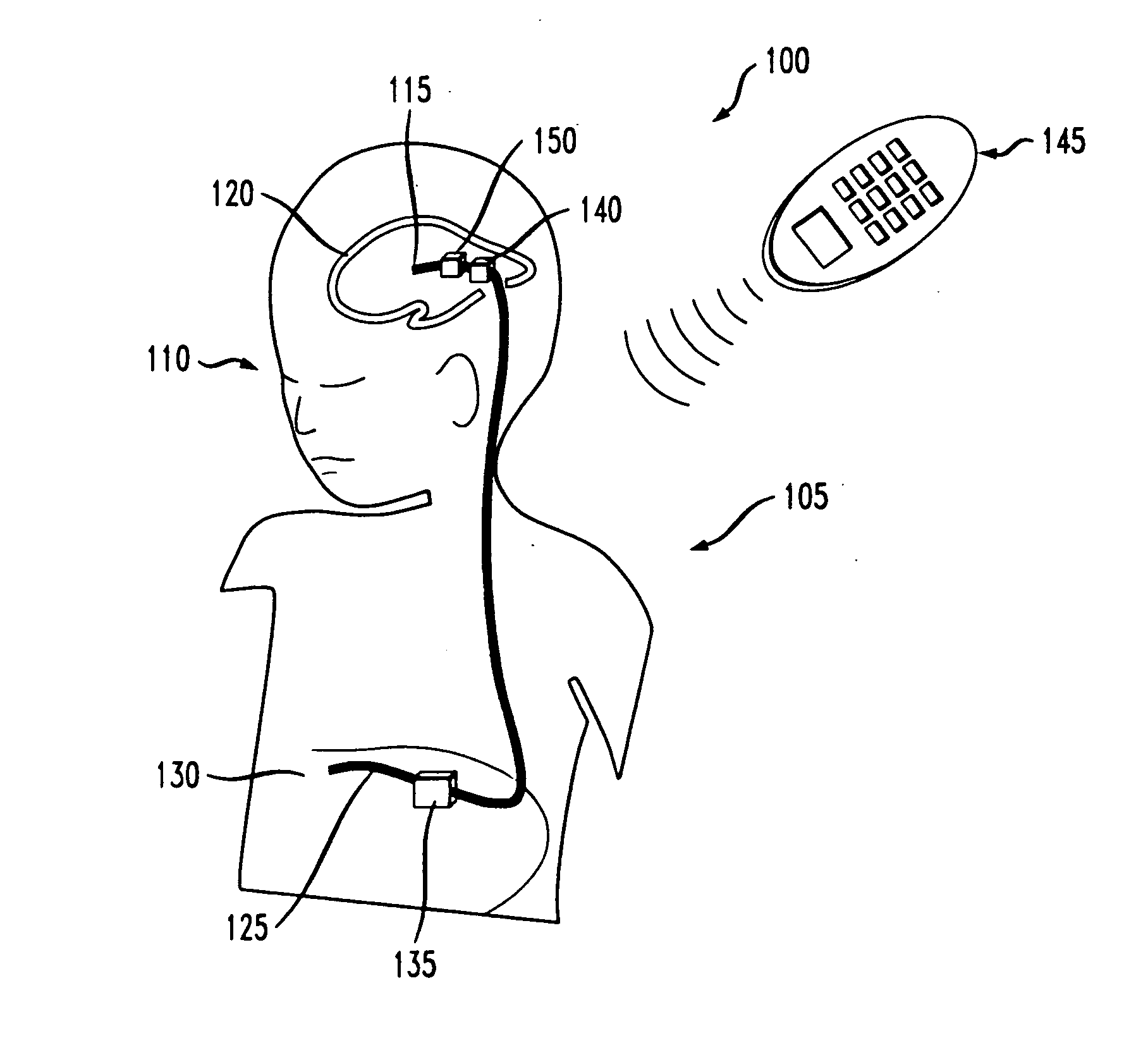 Electrokinetic actuator to titrate fluid flow