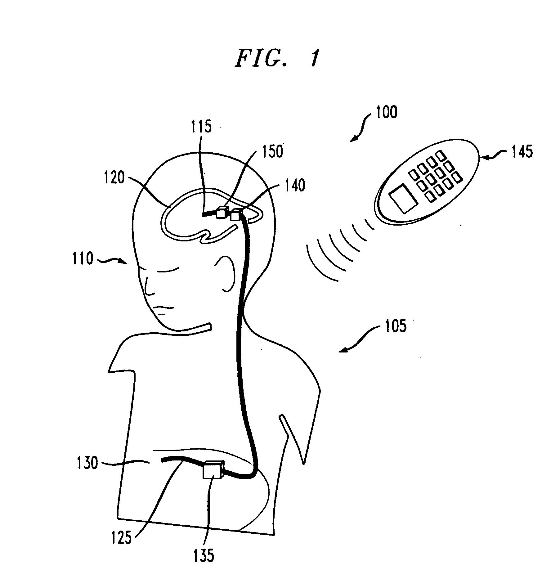 Electrokinetic actuator to titrate fluid flow