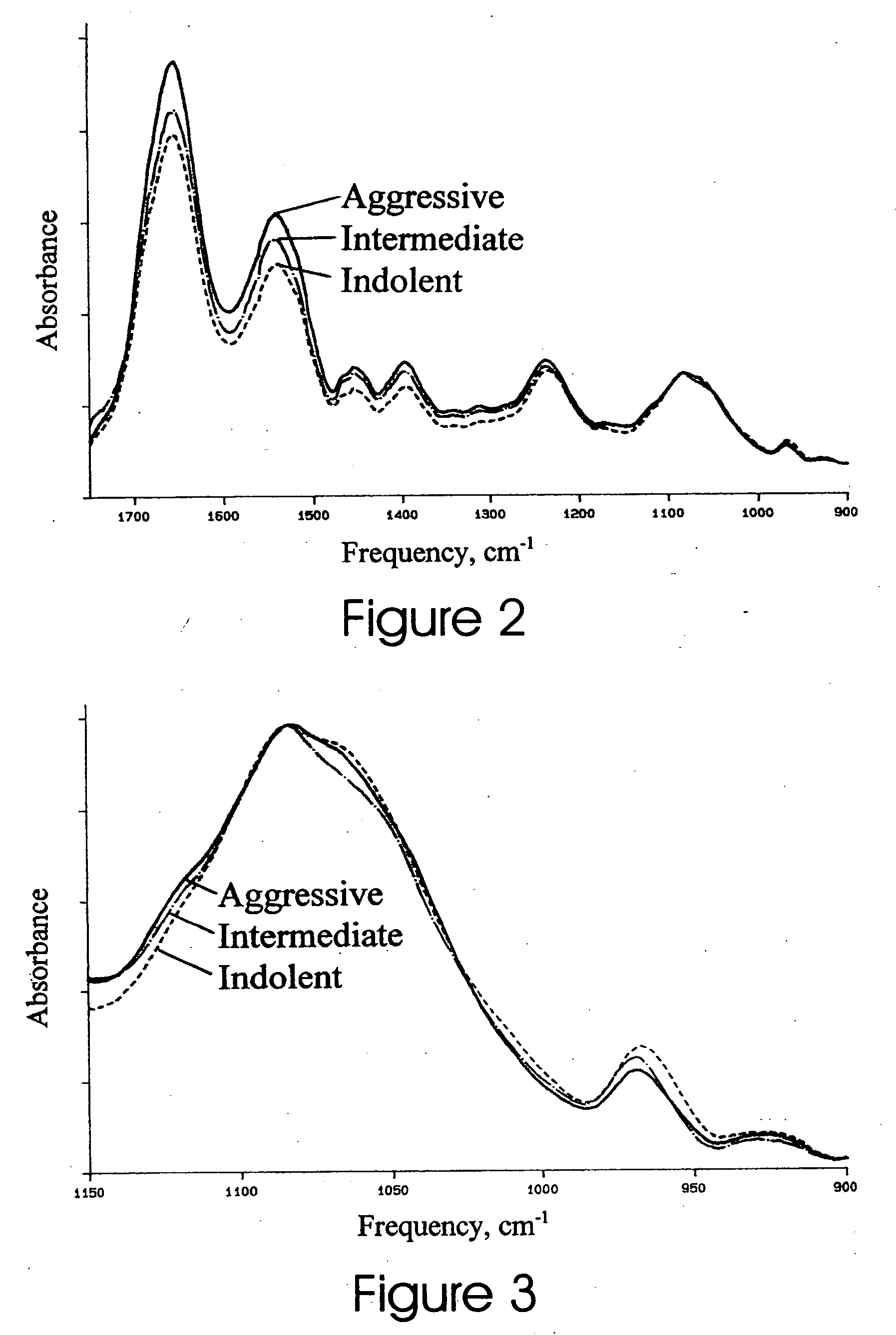 Method of grading disease by Fourier Transform Infrared Spectroscopy