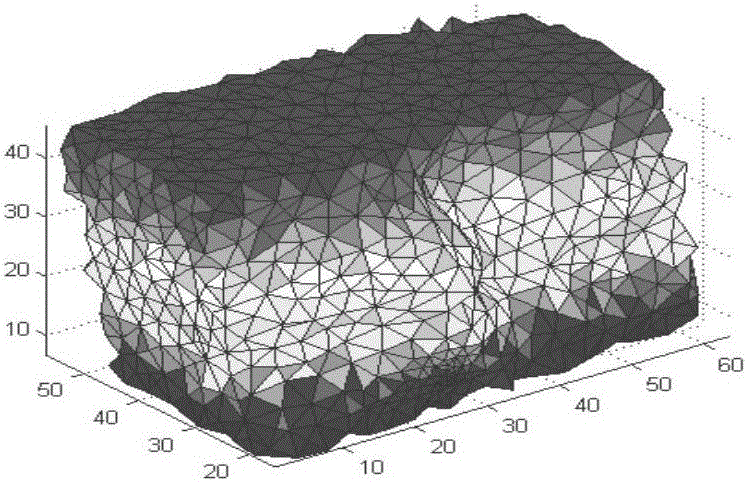 Choroidal neovascularization growth protection method combining constitutive model with finite element