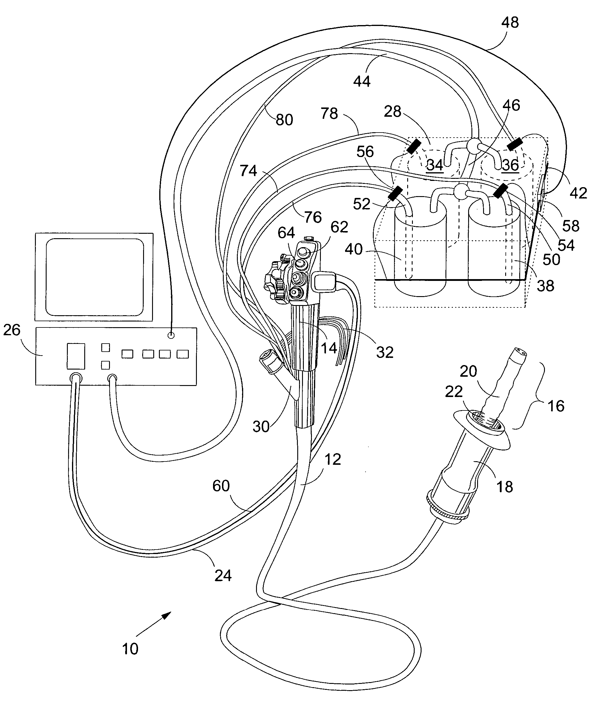 Fluid supply for endoscope