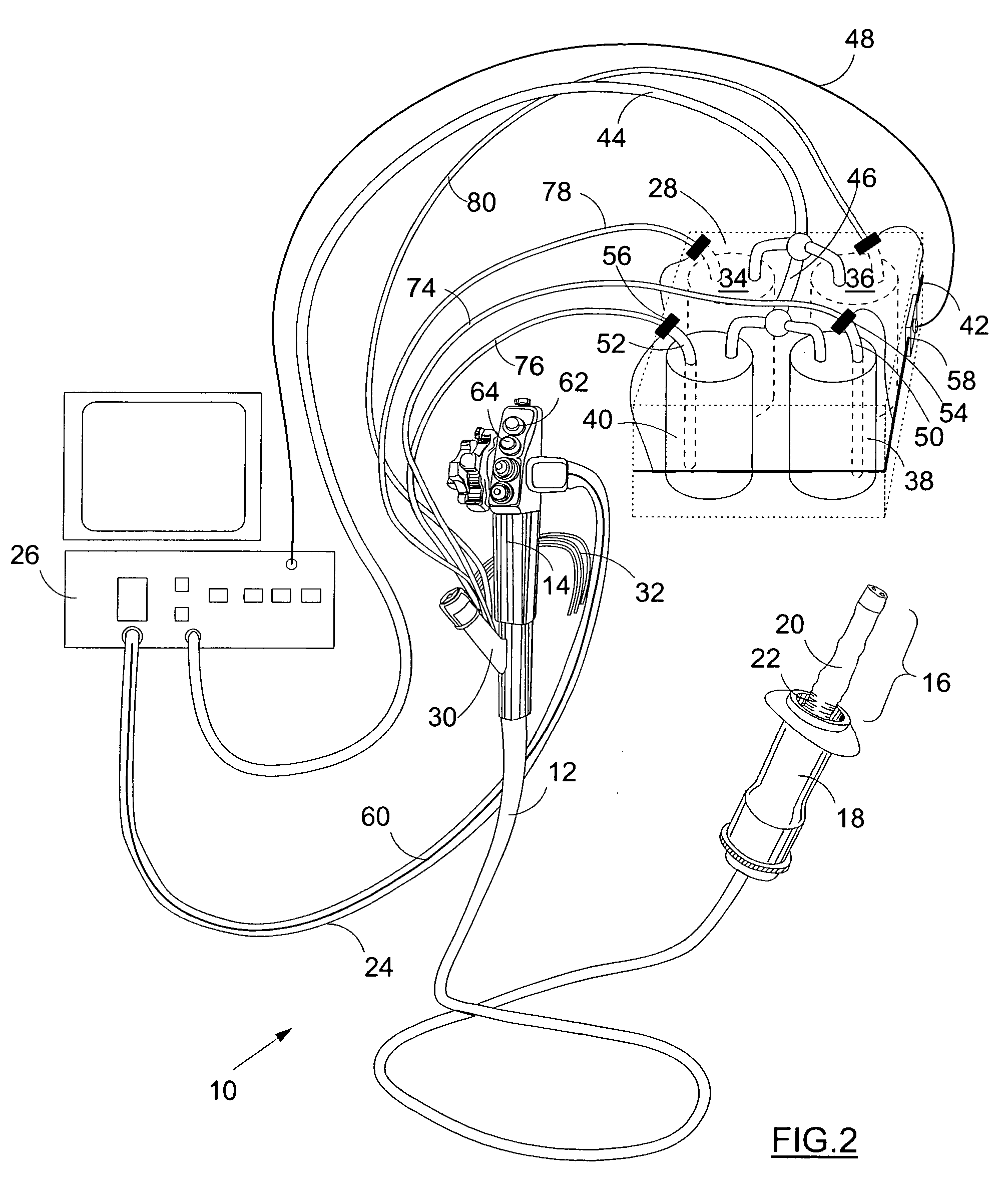 Fluid supply for endoscope