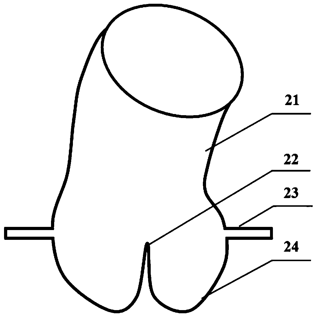 Method for preparing calcified aortic valves based on CT image data